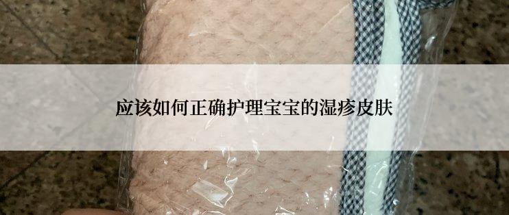 应该如何正确护理宝宝的湿疹皮肤