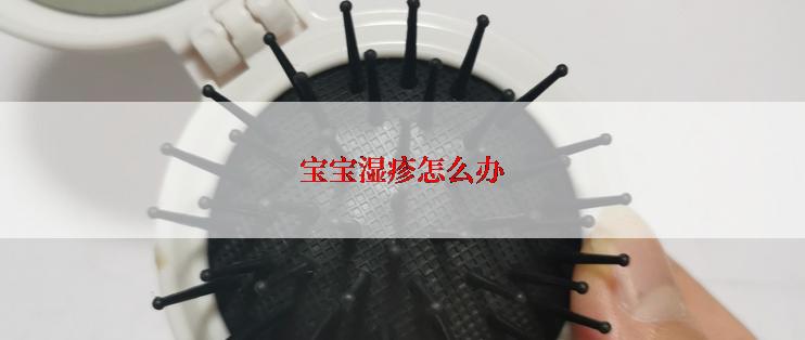 宝宝湿疹怎么办