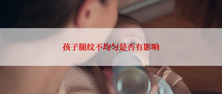 孩子腿纹不均匀是否有影响