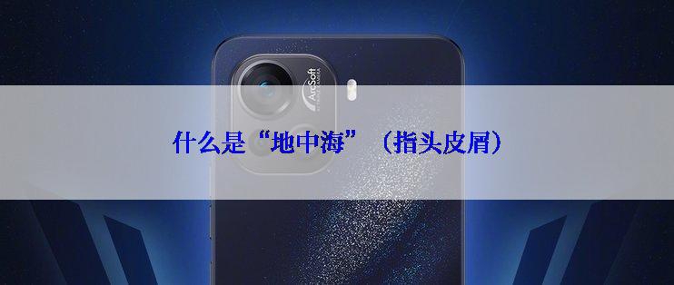 什么是“地中海”（指头皮屑）