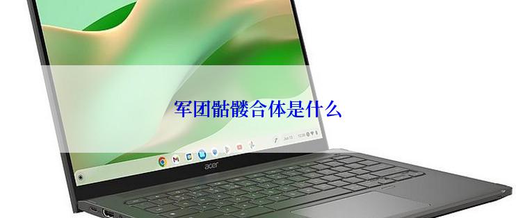 军团骷髅合体是什么