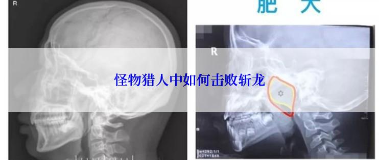 怪物猎人中如何击败斩龙