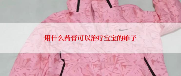 用什么药膏可以治疗宝宝的痱子