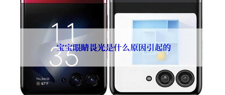  宝宝眼睛畏光是什么原因引起的