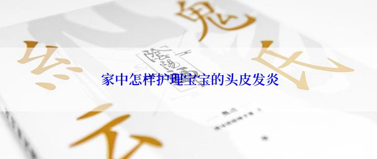  家中怎样护理宝宝的头皮发炎