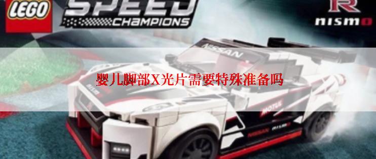  婴儿脚部X光片需要特殊准备吗