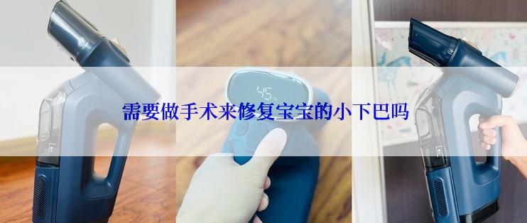  需要做手术来修复宝宝的小下巴吗