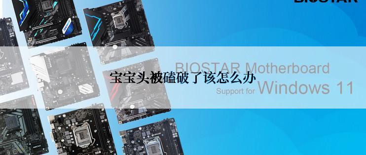 宝宝头被磕破了该怎么办