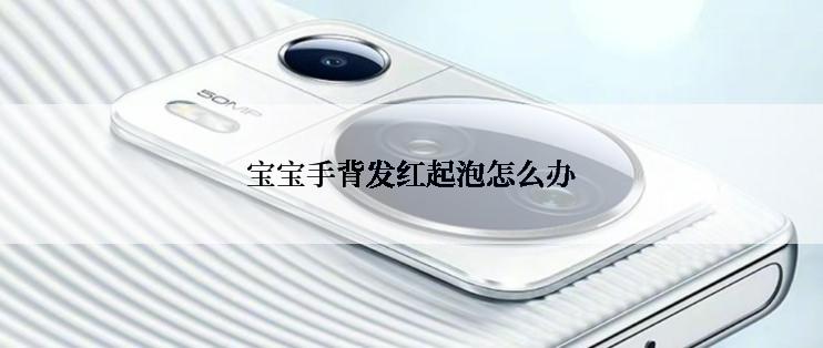 宝宝手背发红起泡怎么办