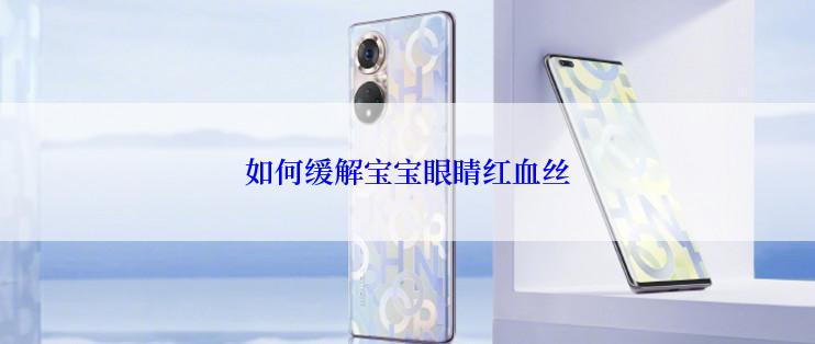 如何缓解宝宝眼睛红血丝