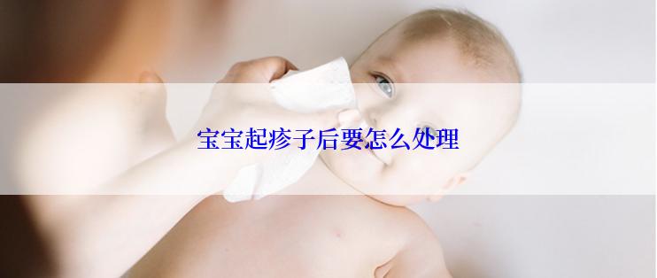 宝宝起疹子后要怎么处理