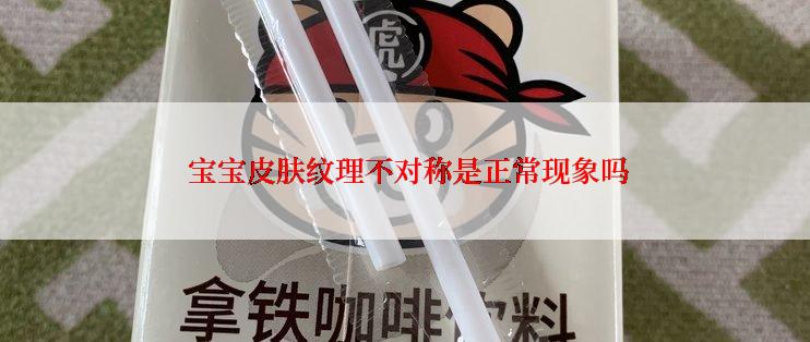  宝宝皮肤纹理不对称是正常现象吗