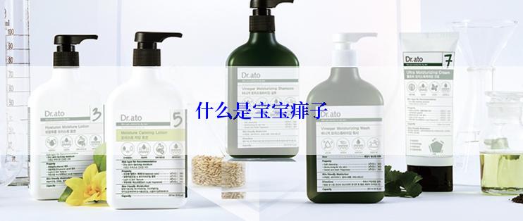 什么是宝宝痱子