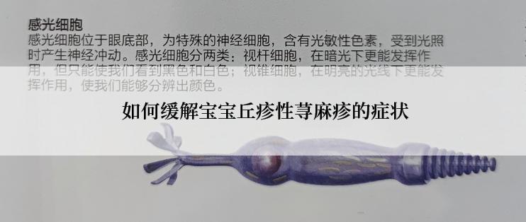  如何缓解宝宝丘疹性荨麻疹的症状