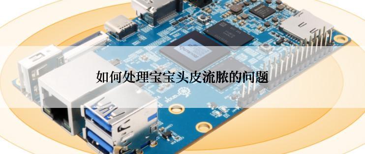 如何处理宝宝头皮流脓的问题