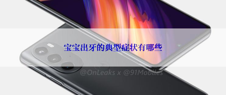 宝宝出牙的典型症状有哪些