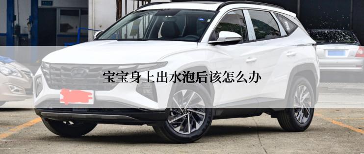 宝宝身上出水泡后该怎么办