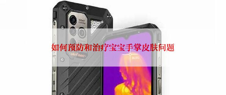 如何预防和治疗宝宝手掌皮肤问题