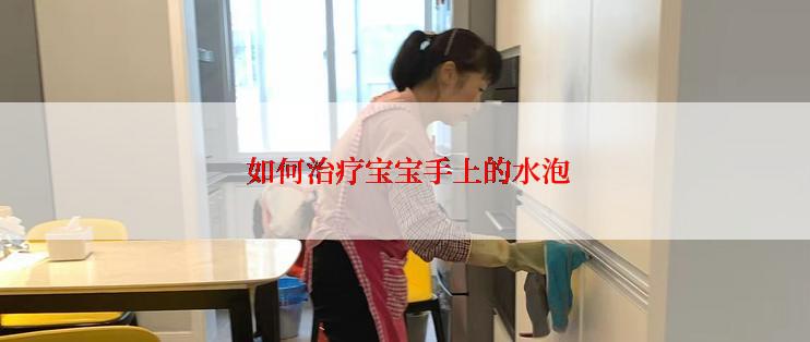  如何治疗宝宝手上的水泡
