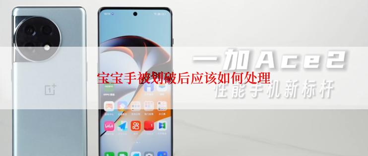 宝宝手被划破后应该如何处理