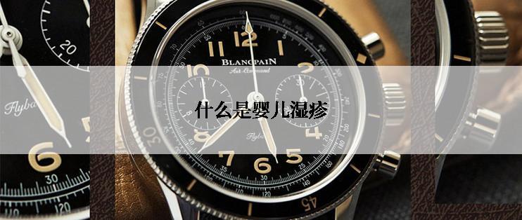 什么是婴儿湿疹