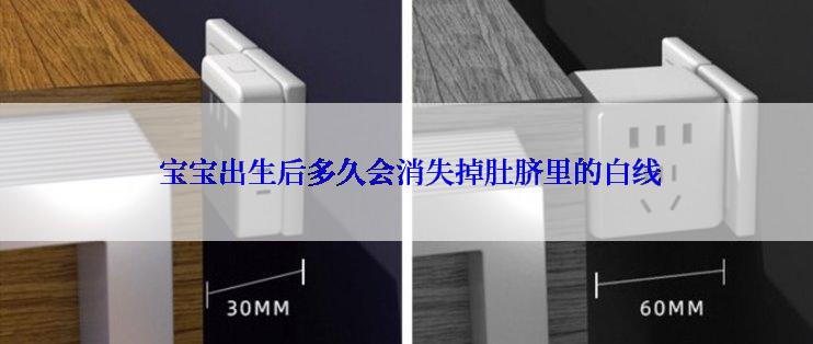  宝宝出生后多久会消失掉肚脐里的白线