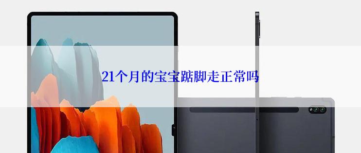 21个月的宝宝踮脚走正常吗