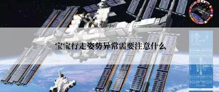  宝宝行走姿势异常需要注意什么