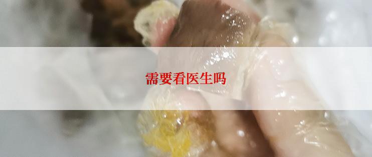 需要看医生吗
