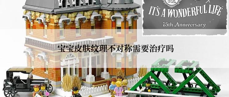  宝宝皮肤纹理不对称需要治疗吗
