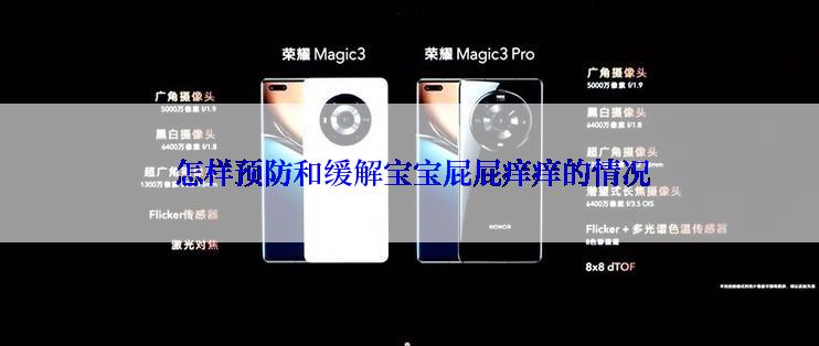  怎样预防和缓解宝宝屁屁痒痒的情况
