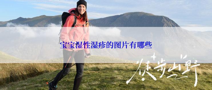 宝宝湿性湿疹的图片有哪些