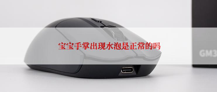  宝宝手掌出现水泡是正常的吗
