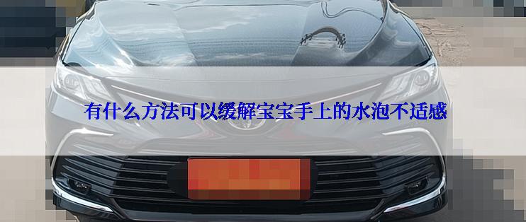  有什么方法可以缓解宝宝手上的水泡不适感