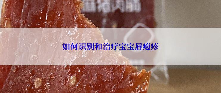如何识别和治疗宝宝唇疱疹