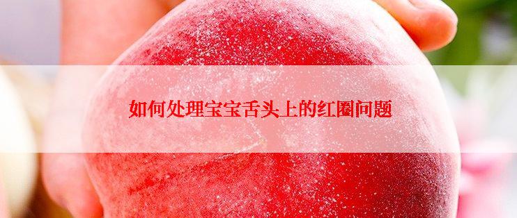  如何处理宝宝舌头上的红圈问题