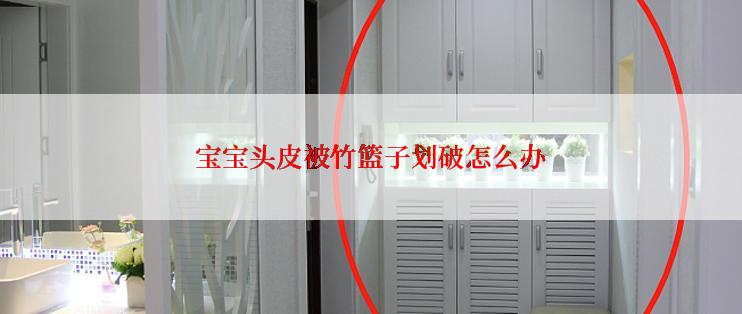 宝宝头皮被竹篮子划破怎么办