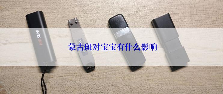  蒙古斑对宝宝有什么影响