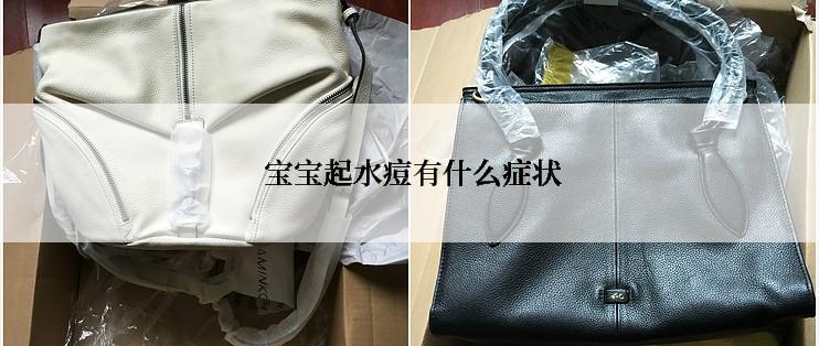  宝宝起水痘有什么症状