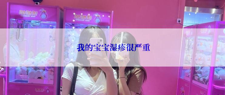 我的宝宝湿疹很严重