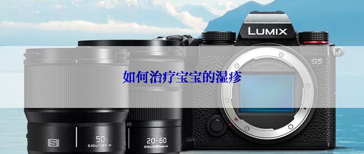 如何治疗宝宝的湿疹