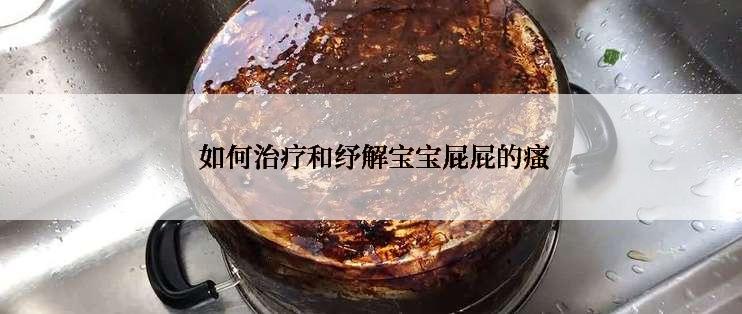  如何治疗和纾解宝宝屁屁的瘙