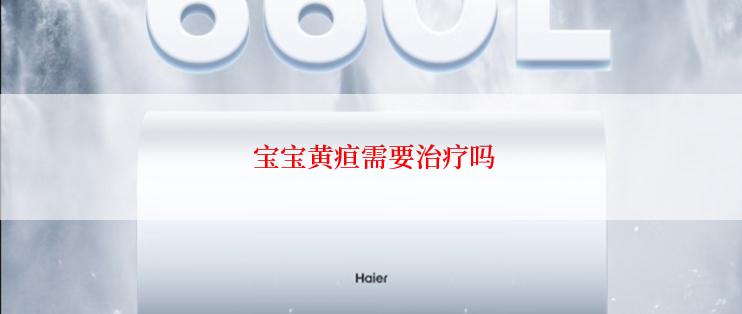  宝宝黄疸需要治疗吗