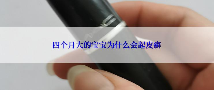 四个月大的宝宝为什么会起皮癣